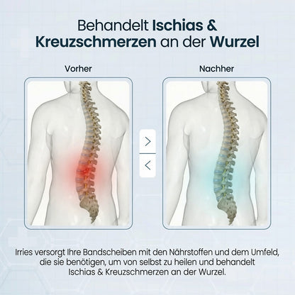 Rückenova® UniFusion